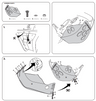 Acerbis Motorschutzplatte passend für KTM EXC-F 450 / 500 2008 2009 2010 2011